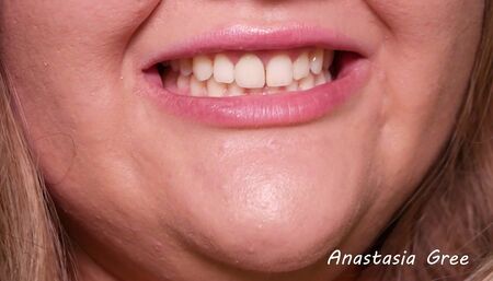 The chubby girl Anastasia Gree shows her sharp teeth