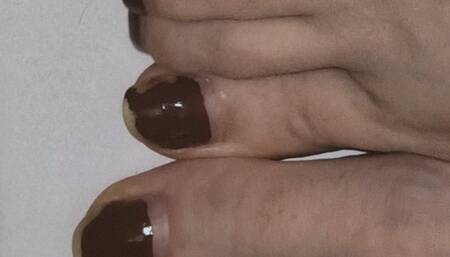 Again cut and peel nails