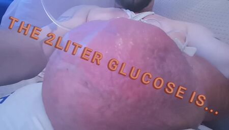 Filling up with 2 liters glucose