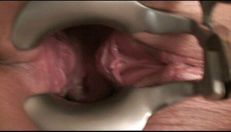 Annadevot - Speculum and champagne