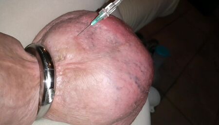 Filling up with glucose 1liter