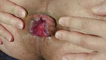 Close up open anus
