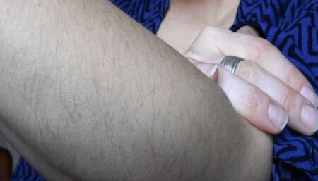 hairy arms