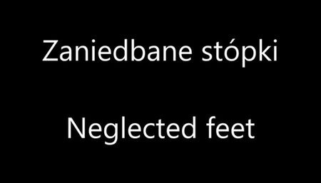 Neglected Feet