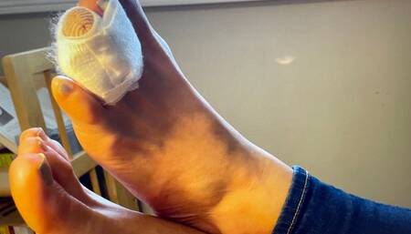 Lucki's Broken Toe Update WMV version