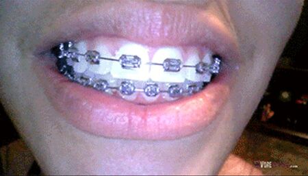 Giantess Vore Wink's Endoscopic Investigation 720 HD