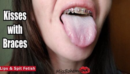 Kissing with Braces and Spit Play - Mouth & Tongue Fetish - Brackets - MissBohemianX - WMV
