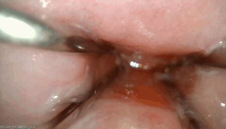 endocervical speculum extreme closeup (1080 wmv)