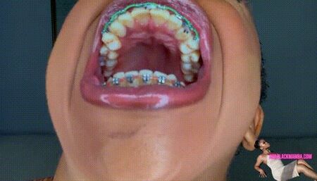 The Dentist Found Something in My Mouth