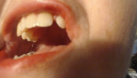 My sharp teeth custom show