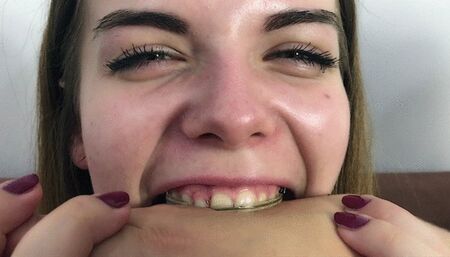 Klara’s Braces First Time Bite - HD 1920x1080