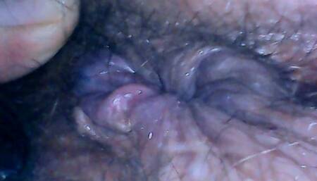 Hairy exploration peeing with endoscope on the toilet