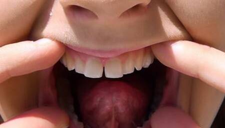 My Open Mouth HD-720