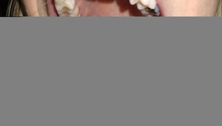 Blueberry men! Crisp mouth views