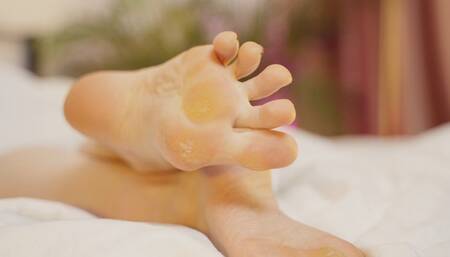 Callused feet resting in bed (4K)