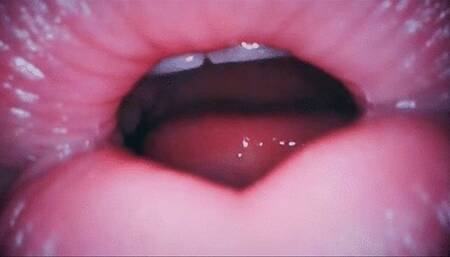 Endoscopic play mp4 HD