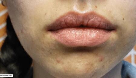 Return of KissyMissy