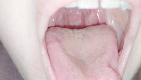 My bright red uvula