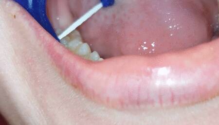 Flossing and burping wmv