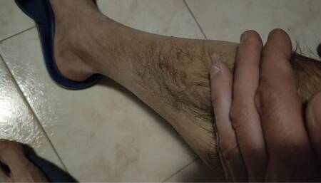 Showing scars and wounds on my body (avi)