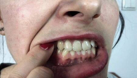 Ala - Mouth Tour And Bites - UHD 3840x2160 - 4K