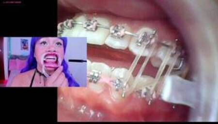 Lila Jordan, suspenders, braces