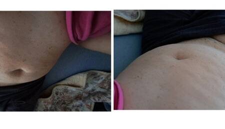 Super Noisy Loud Gurgly And Hungry Belly plus Farting and Lotsa Burping