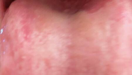 Showing you my uvula while burping wmv