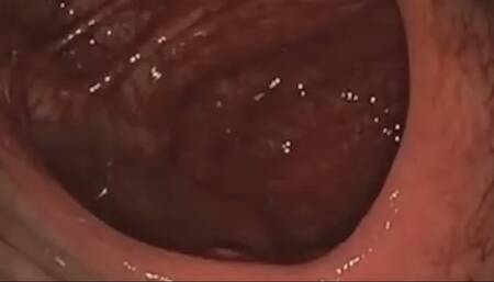 Yummy Tiny Human Snack