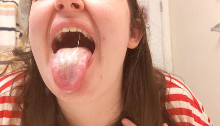 Chugging water, checking out my mouth, and using mouthwash