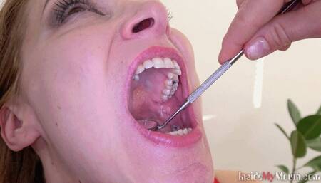 Inside My Mouth - Radka got mouth exam (HD)