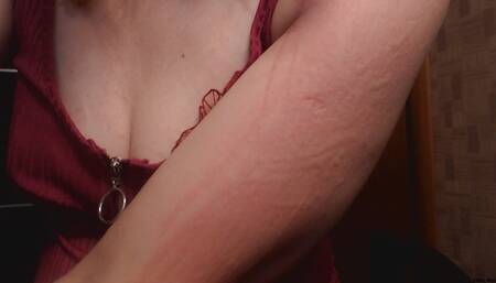 scratching n leave c marks on