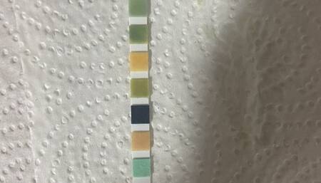 Nurse Gets A Urinalysis