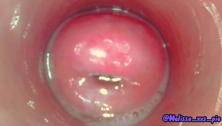 Diving into my inner world - endoscope version