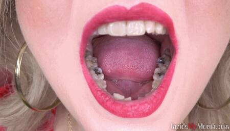 Inside My Mouth - Lenka got mouth exam (4K)