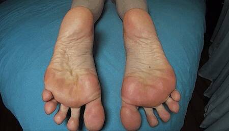 Big wrinkled soles close up (PFW)