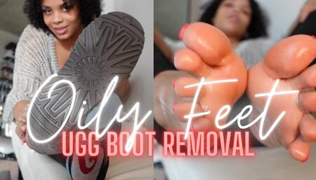 Ugg Boot Removal with Oily Feet