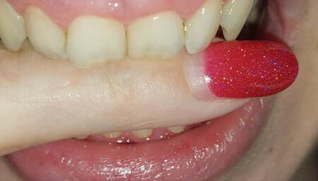 I bite my finger ---