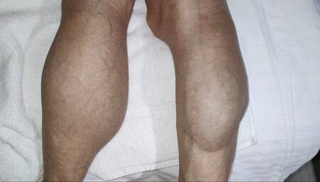 Iron Ivy, the white sheets, calves, blue veins