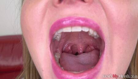 Inside My Mouth - Lola has a dental check-up (MOBILE)