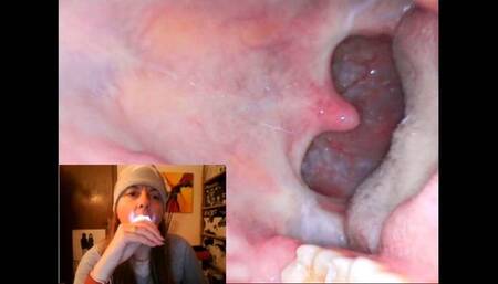 Endoscopy catarrh saliva and mouth exploration 1080HD