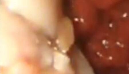 Whole chicken digestion endoscopy 720HD