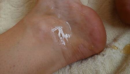 Ankle Heartbeat with Honey