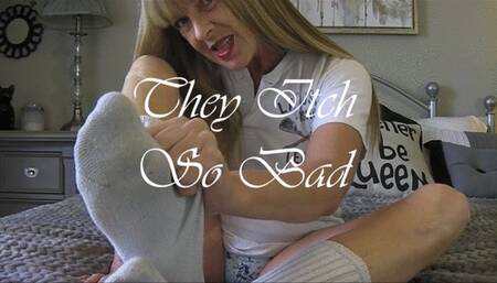 THEY ITCH SO BAD mov