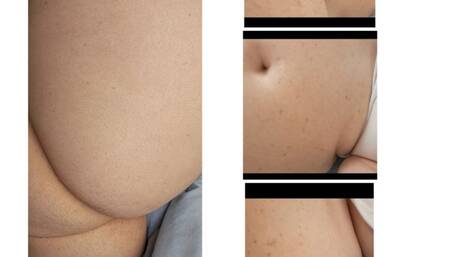 New Belly Noises Plus SNEEZING AND FARTING