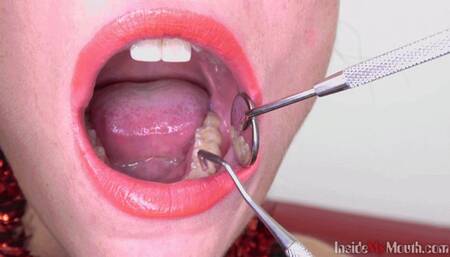 Inside My Mouth - Pauli has a dental check-up (HD)