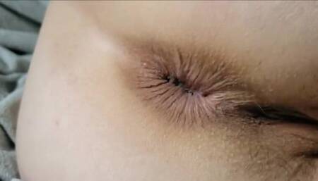 Another beautiful morning in the land of my ass