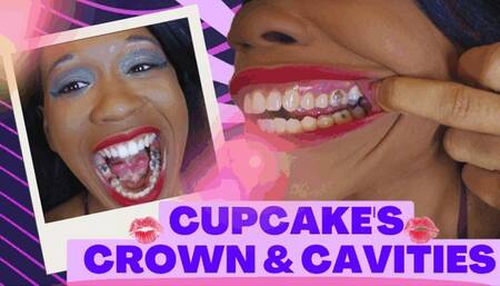 Cupcake's Crown & Cavities: MODDED MOUTH TOUR IN 4K