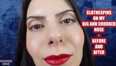 CLOTHESPINS ON MY BIG AND CROOKED NOSE - BEFORE AND AFTER