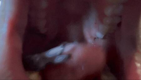 Bry Swallows Dentist- MP4